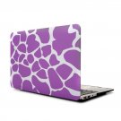 Ultra Slim Giraffe's Spots Hard Case for MacBook Air 11.6" & Free Keyboard Cover(Random)-283B