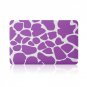 Ultra Slim Giraffe's Spots Hard Case for MacBook Air 11.6" & Free Keyboard Cover(Random)-283B