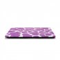 Ultra Slim Giraffe's Spots Hard Case for MacBook Air 11.6" & Free Keyboard Cover(Random)-283B