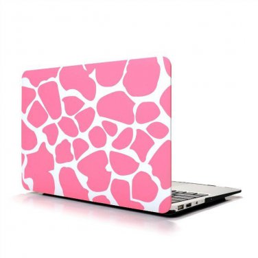 Ultra Slim Giraffe's Spots Hard Case for MacBook Air 11.6" & Free Keyboard Cover(Random)-283C