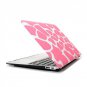 Ultra Slim Giraffe's Spots Hard Case for MacBook Air 11.6" & Free Keyboard Cover(Random)-283C