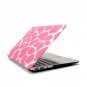 Ultra Slim Giraffe's Spots Hard Case for MacBook Air 13.3" & Free Keyboard Cover(Random)-287C