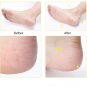 4 Pair Healthy Replacement Roller Heads For Scholl Velvet Amope Pedi Foot Refills