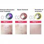 Face Therapy Acne Light Laser Pen Soft Scar Wrinkle Removal Treatment