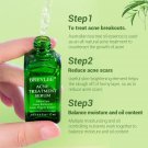 Breylee acne treatment serum
