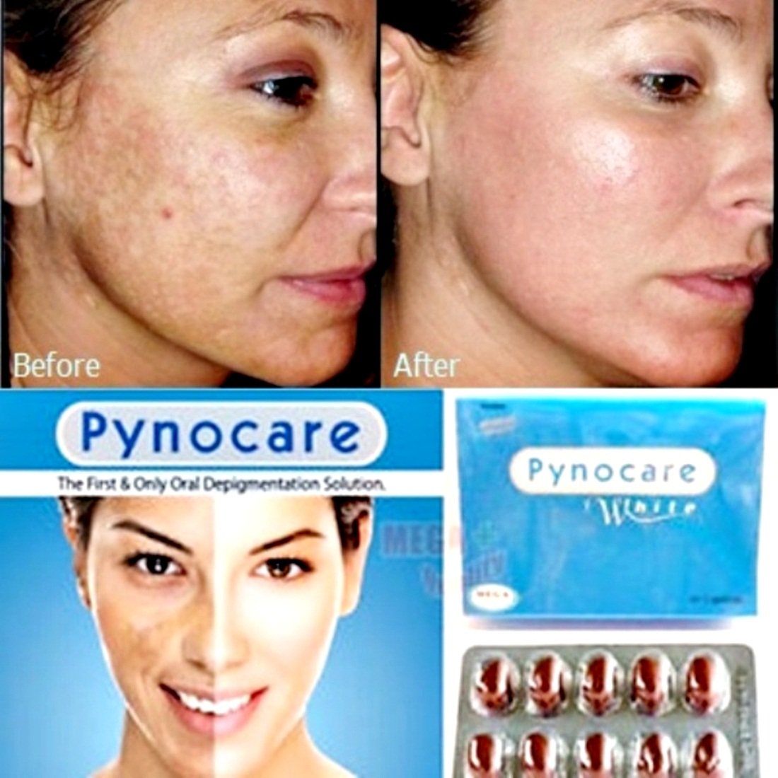 100Herbal 120 Capsules Pynocare Anti Melasma Whitening