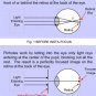 Anti Fatigue Pinhole Stenopeic Vision Improve Eyesight Eye Care Glasses
