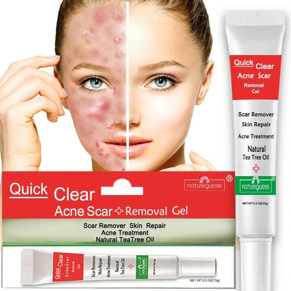 Acne Treatment Face Cream for Scar Repair Blackhead Removal & Oil Control