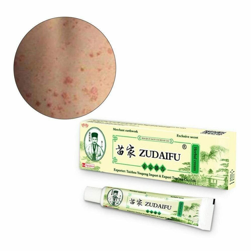 2 x Chinese Herbal Skin Care Cream Skin Problem Balm Useful Ointment Health Care