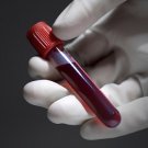 Optimum Health Options Thyroid Panel Test