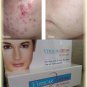 Vinscar Intensive Acne Scar Reducer Cream - Reduces Acne Scars