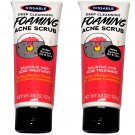 2 X 4.5 oz Kissable Deep Cleansing Foaming ACNE Scrub Helps Remove Oil & Dirt