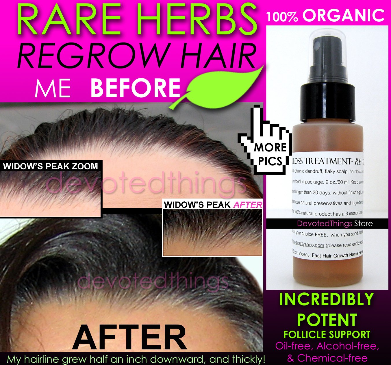 BEST ORGANIC Hair Regrowth Treatment Hair Loss Thinning ...