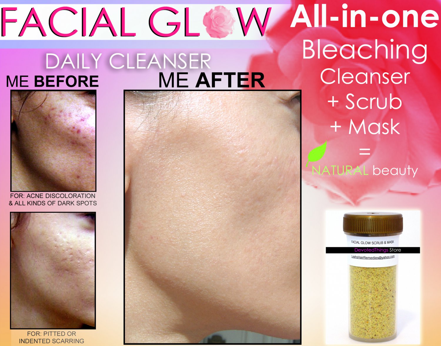 Facial Glow Scrub And Mask Daily Cleanser Acne Scars Skin Bleaching Soap