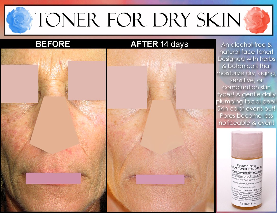 NATURAL ALCOHOL FREE TONER for Dry, Sensitive, Aging Skin ...