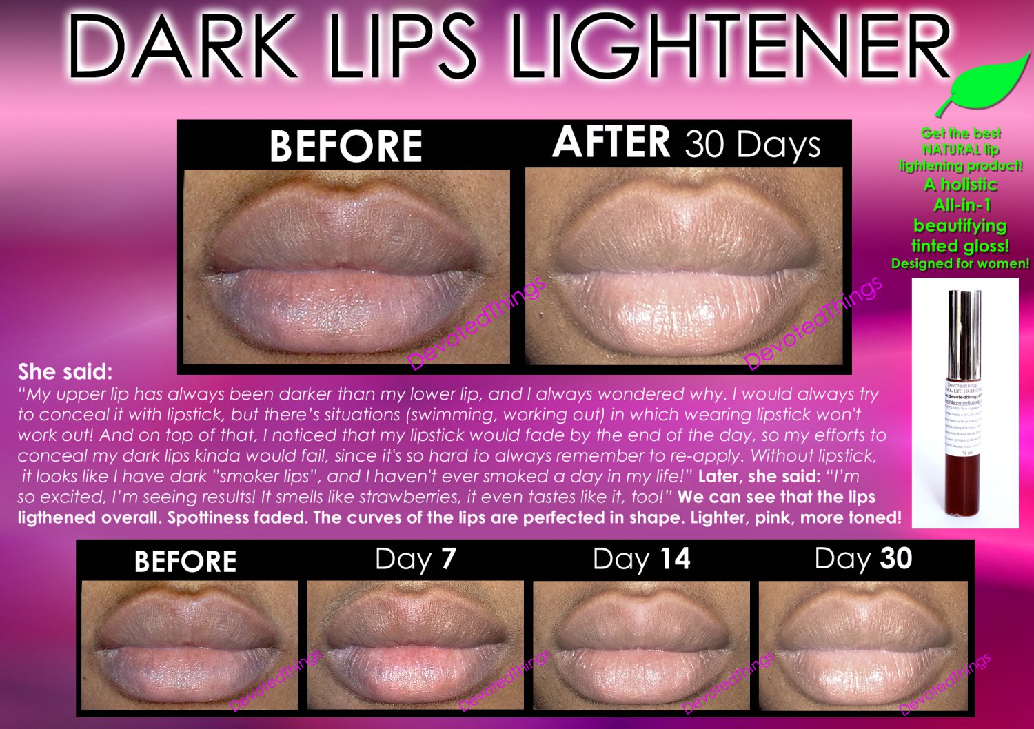 Best Dark Lip Lightening Natural Product Whitening Treatment To Get