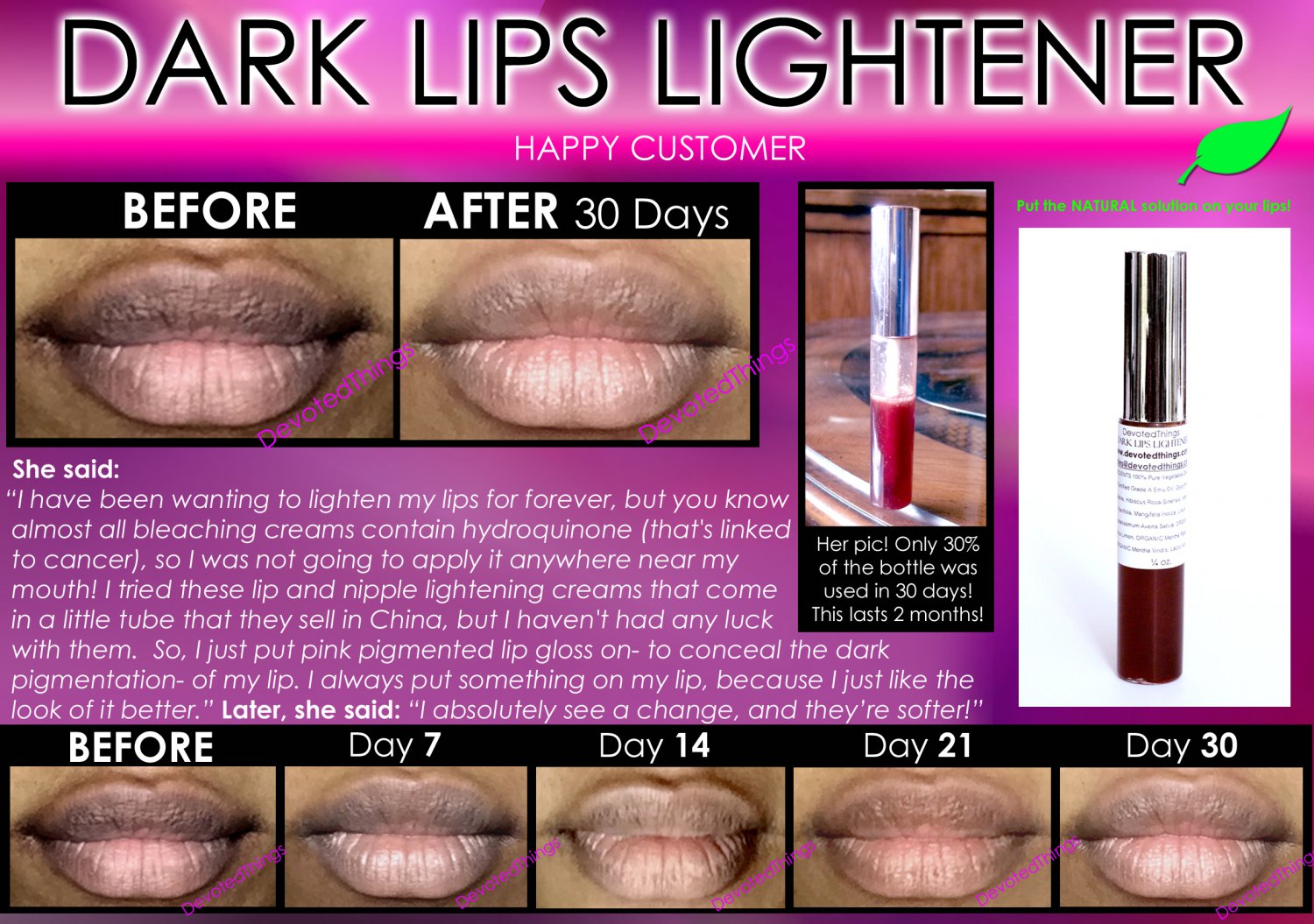 Best Dark Lip Lightening Natural Product Whitening Treatment To Get Pink Lips