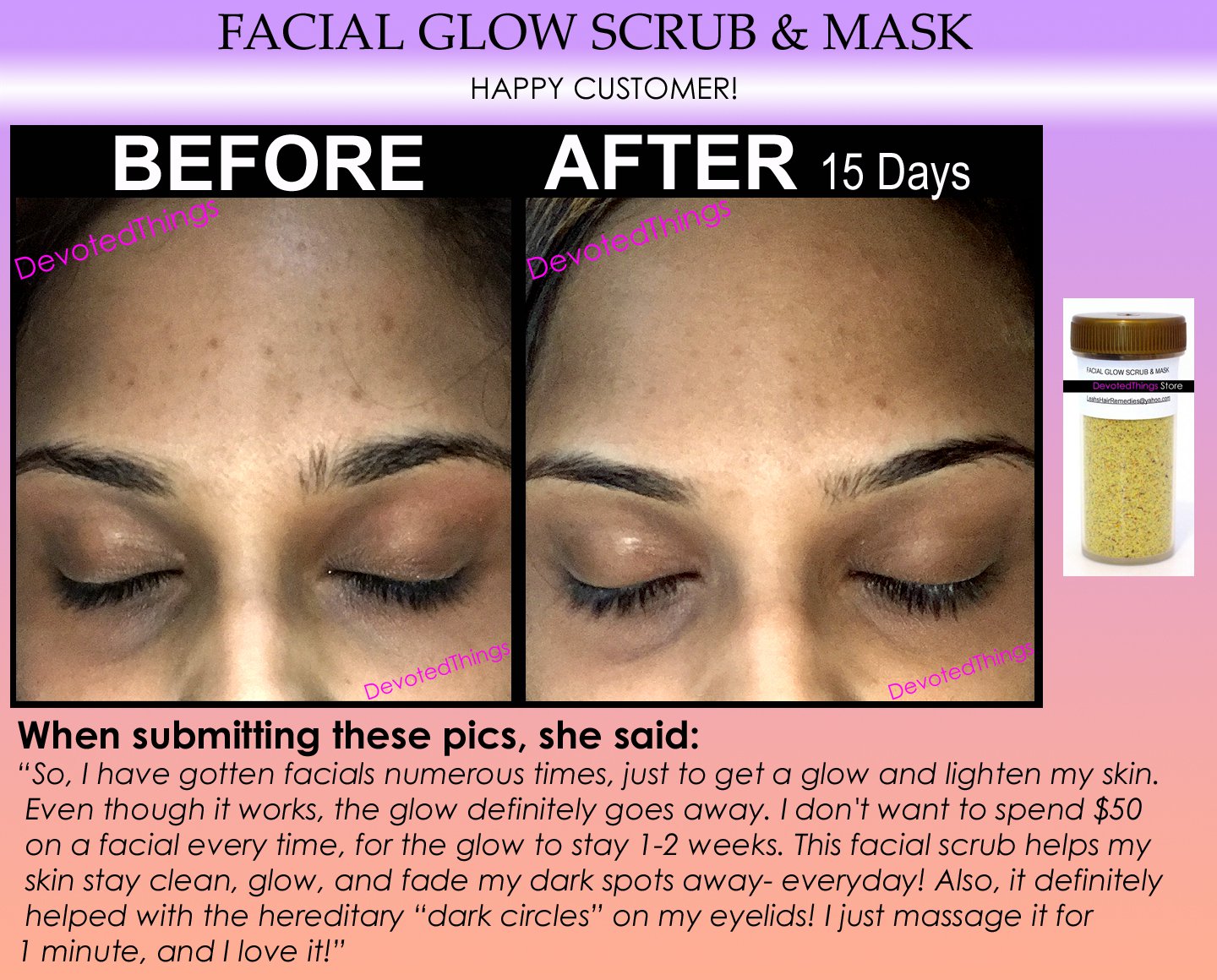 FACIAL GLOW Scrub & Mask Daily Cleanser Acne Scars Skin Bleaching Soap