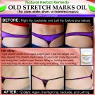 Natural Stretch Mark Remover Oil Herbal Remedy for Older White Silver Indented