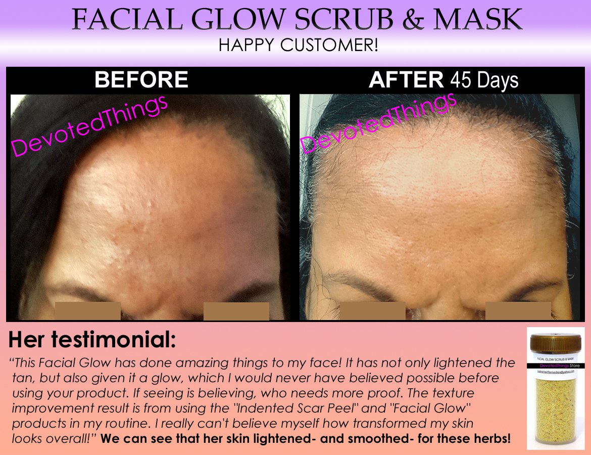 FACIAL GLOW Scrub & Mask Daily Cleanser Acne Scars Skin Bleaching Soap