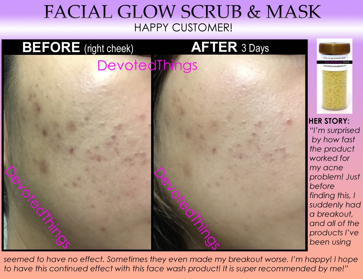 FACIAL GLOW Scrub & Mask Daily Cleanser Acne Scars Skin Bleaching Soap Natural Herbal Bleach