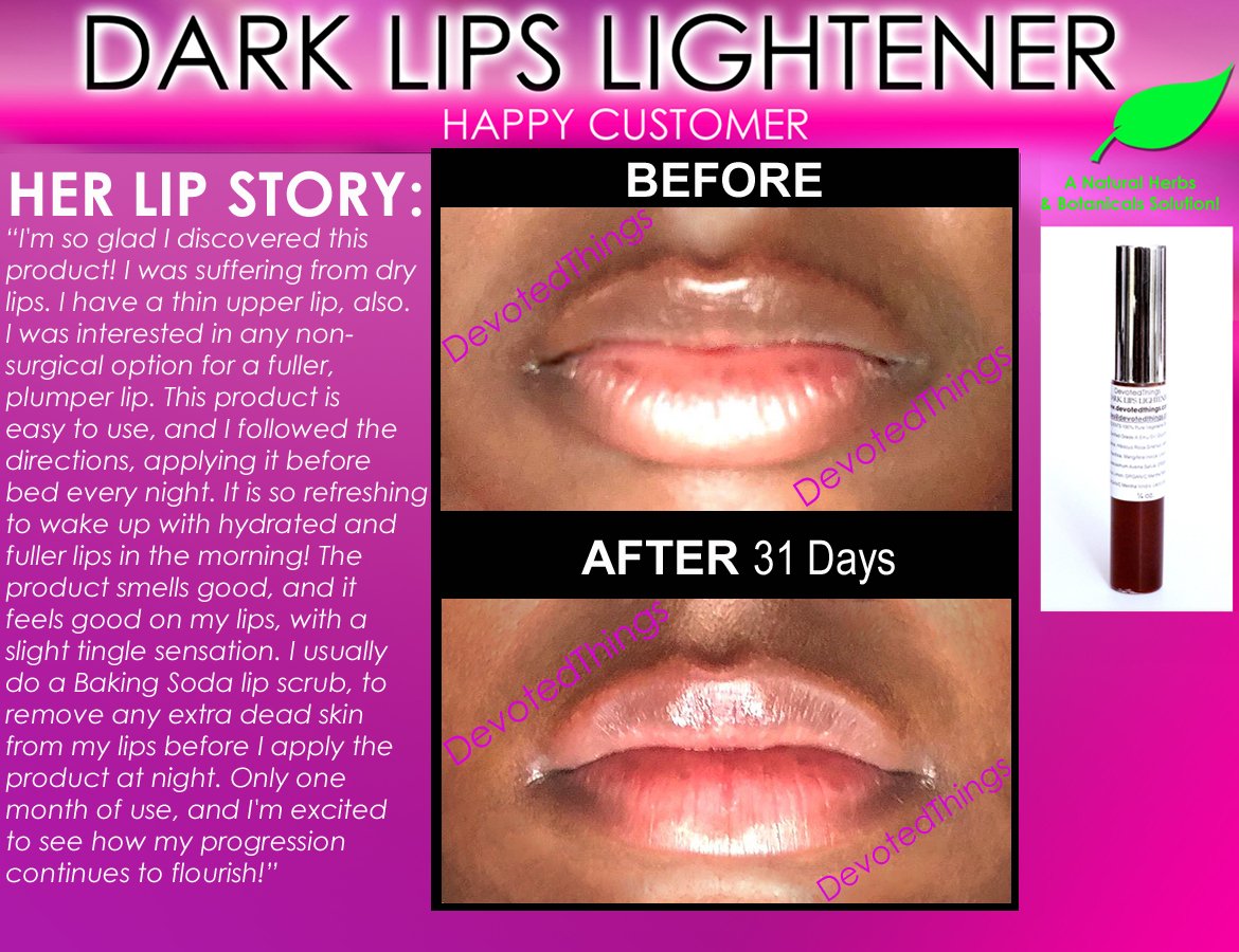 Best Dark Lip Lightening Natural Product Whitening Treatment To Get Pink Lips