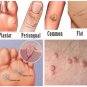 Wart Remover &acirc;�� Wart Remover, Skin Tag, Mole &acirc;�� 10ml