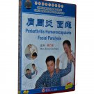 Periarthritis Humeroscapularis Facial Paralysis (DVD)-Chinese Medicine Massage