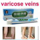 Varicose Veins Treatment Leg Acid Bilges Itching Earthworm Lumps Cream(Lot of 2 packs)