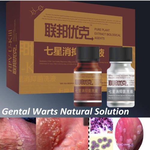 Clear Genital Warts Removal Condyloma Acuminatum Treatment Chinese Herbs