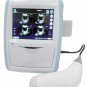 ultrasound portable Bladder Scanner Touch Screen and  printer inside
