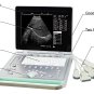 Veterinary Ultrasound  B Scanner portable Laptop Ultrasound Scanner