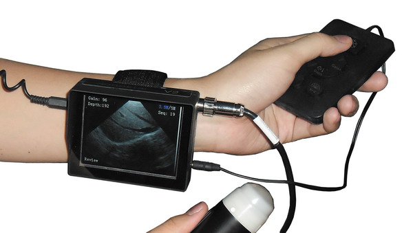 Veterinary Pregnancy Mini Portable Wrist Handheld Ultrasound Scanner With Probe