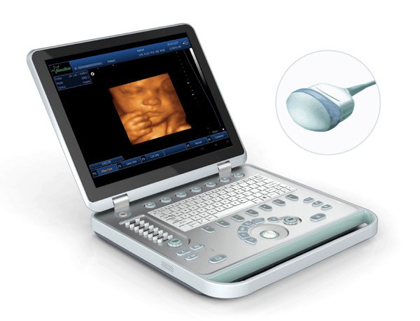 Ultrasound B Scanner Portable B Scanner 4D Laptop scanner machine  CE certifica