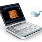 Ultrasound B Scanner Portable B Scanner 4D Laptop scanner machine  CE certifica