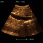 Ultrasound B Scanner Portable Scanner SS-8 Laptop scanner machine CE certifica
