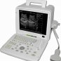 Portable Digital Ultrasound Machine Scanner Ultrasound Diagnosis B Scanner black