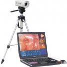 Digital Electronic Colposcope SONY Camera Colposcope/Mammary Device SVC-50 CE