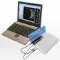 Ophthalmic Ultrasound Scanner  SAB-200 Ophthalmic A/B Scanner