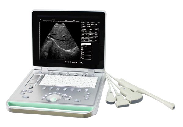 Portable B Scanner ultrasonic black white Imaging System  laptop CE certificate
