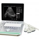 Portable B Scanner ultrasonic black white Imaging System  laptop CE certificate