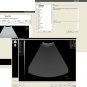 Ultrasound B Scanner Portable B Scanner Ultrasound B Scanner Box 3D imaging