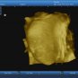 Ultrasound B Scanner Portable B Scanner Ultrasound B Scanner Box 3D imaging