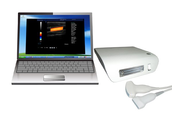 ultrasound machine Color Doppler box Ultrasound equipments Portable CBox-5