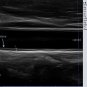 Ultrasound Color Doppler Trolley C100 Trolley Color Doppler Ultrasound device