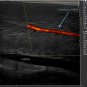 Ultrasound Color Doppler Trolley C100 Trolley Color Doppler Ultrasound device