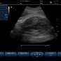 Ultrasound Color Doppler Portable SS-1000 Color Doppler System