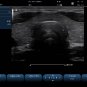 Ultrasound Color Doppler Portable SS-1000 Color Doppler System