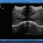 Veterinary Ultrasound Scanner vet V9 portable Laptop Ultrasound scanner device