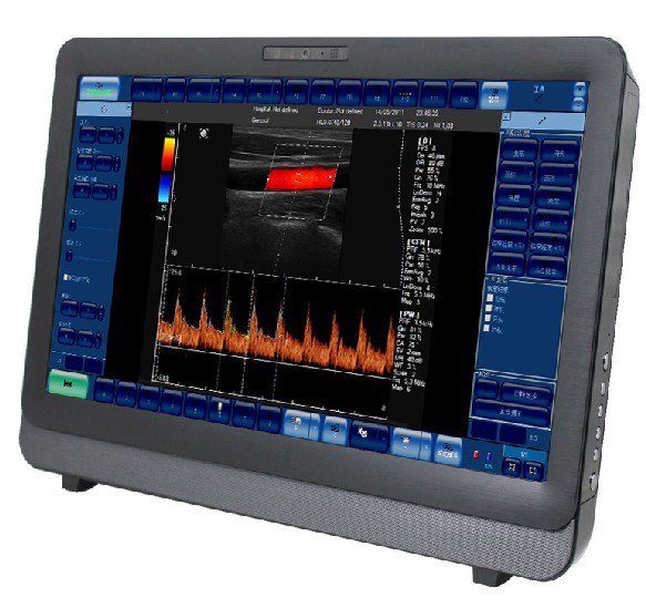 C8 Color Doppler Ultrasound System(Touch Screen)